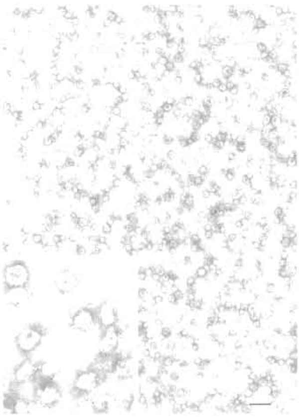 FIGURE 2 Electron micrograph showing a synaptic vesicle fraction purified by the procedure described in Section IIIB (negative staining). (Inset) Magnification of a field following immunogold labeling for the synaptic vesicle protein synaptophysin. For methods, see Jahn and Maycox (1988). Bar: 200nm. Electron micrographs courtesy of Dr. Peter R. Maycox (London, UK).