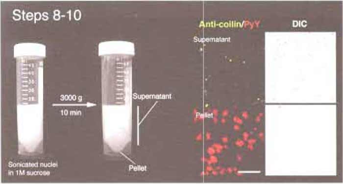 FIGURE 2 Steps 8-10 of the procedure. Note the small pellet after centrifugation. (Right) Microscope images of the supernatant and pellet. Anticoilin antibodies (5P10, green) and pyronin Y (red) were used to label CBs and nucleoli, respectively. Bar: 10µm.