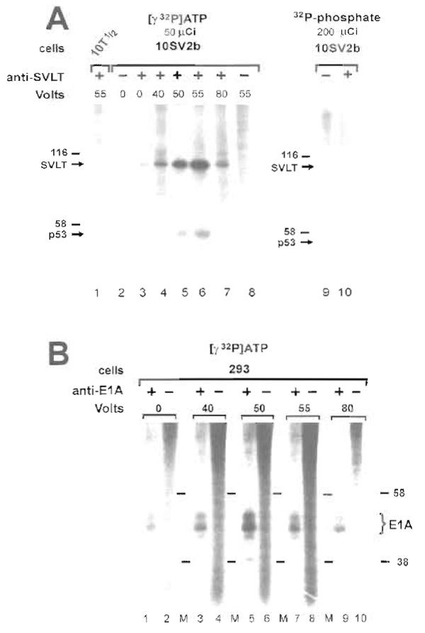 FIGURE 3 Labeling of the simian virus 40 large tumor antigen or adenovirus EIA through in situ electroporation
of [γ32P]ATP. (A) Mouse 10T½ cells (lane 1) or their SVLT-transformed derivatives (line 10SV2b, lanes 2-8) were grown on 50 × 30mm conductive areas (Figs. 1C and 1D). A solution containing 50µCi [γ32P]ATP in phosphate-free DMEM was added to the cells, and six capacitor-discharge pulses of 10µE 40-80 V were applied as indicated. Cells were placed in a humidified incubator for 30min. For a comparison (lanes 9 and 10), the same SVLT-transformed cells were labeled in vivo with the indicated amounts of [32P]orthophosphate. SVLT was precipitated from detergent extracts with the pAbl08, anti-SVLT antibody (lanes 1, 3-7, and 10), or normal mouse IgG (lanes 2, 8, and 9) and labeled proteins were resolved by acrylamide gel electrophoresis. Dried gels were exposed for 1 h to Kodak XAR-5 film with an intensifying screen. Note the intense and specific labeling of SVLT and the associated phosphoprotein, p53, by in situ electroporation (lanes 5 and 6) compared to cells labeled in vivo with 200µCi [32P]orthophosphate (lanes 9 and 10). (B) Human 293 cells transformed with adenovirus DNA were labeled as described earlier and extracts were preadsorbed with normal mouse IgG (lanes 2, 4, 6, 8, and 10) or immunoprecipitated using the M73, anti-E1A antibody (lanes 1, 3, 5, 7, and 9). Bracket points to the position of the phosphorylated E1A bands. M, molecular weight marker lanes.