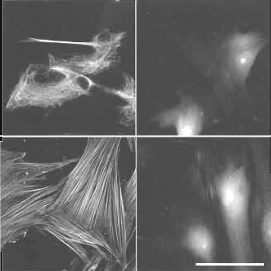 FIGURE 6 Effect of permeabilization/prefixation on cytoskeletal labeling. Human dental ligament cells on glass coverslips. Top, bottom (left) with and top, bottom (right) without permeabilization/prefixation as described in Fig. 1. Labeling: vimentin (top): Cy3 antivimentin (monoclonal mouse, www.amershambiosciences.com). F-actin (bottom): TRITC-phalloidin (www.sigma-aldrich.com). Cytoskeletal labeling only in permeabilized cells. In nonpermeabilized cells actin is partially accessible for small phalloidin (1250 Da) but not for large anti-vimentin IgG (~150,000 Da). Scale bar: 25µm. From Baschong et al. (1999).