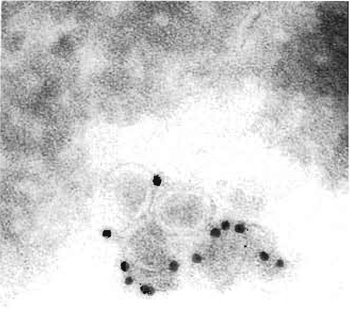 FIGURE 1 Cryoimmuno-EM of BHK-21 cells incubated with equine arteritis virus (EAV), Bucyrus strain. Cells were fixed, sectioned, and labelled for the EAV surface glycoprotein GP5. Bar: 0.2 mm.
