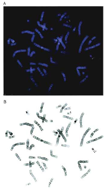 FIGURE 1 (A) Two-color hybridization of two cosmid clones mapping to chromosome 22. One cosmid was biotinylated and detected with avidin-Texas red (red) and the second cosmid was labeled with digoxigenin and visualized using FITC-conjugated antibodies (green). (B) Black-and-white inverted image of the metaphase shown in A. The chromosomes appear essentially G banded, although the 9qh region is dark in this example.