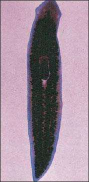 Stained planarian