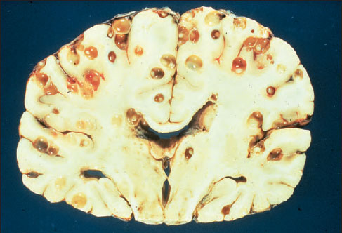 brain of a person 