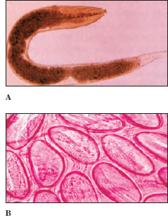 Pinworms, Enterobius vermicularis. A, Female worm from human large intestine (slightly flattened in preparation), magnified about 20 times. B, Group of pinworm eggs, which are usually discharged at night around the anus of the host, who, by scratching during sleep, gets fingernails and clothing contaminated. This may be the most common and widespread of all human helminth parasites.