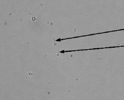Germ-tube formation by Candida albicans. The two yeast cells in the center have sprouted a germ tube (arrows) when incubated for 2 hours in horse serum. Not all cells in the preparation will form the germ tube. The halo around the cells represents light refraction and not a capsule.