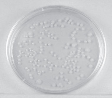 Single isolated colonies obtained during the plate count.