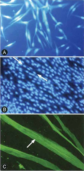 FIGURE 1 Myocytes and myotubules in various stages of differentiation. (A) Individual myocytes prior to differentiation. (B) Myotubules showing the classic "peas in a pod" appearance of multiple nuclei within single cells. Note that there are several mononucleated as well as multinucleated cells in the culture. (C) Striations in differentiated myotubules.
