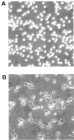 FIGURE 1 Bright-field microscopy images representing an example of HL-60 cells either untreated in suspension (A) or attached and spread following a 3-day treatment with 10nM PMA (B).
