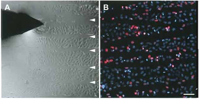 FIGURE 1 (A) Scratch replication labeling of human neuroblastoma cells. Arrowheads indicate scratches in the monolayer applied with the tip of a hypodermic needle (top left) in the presence of Cy3-dUTP. (B) Cells were fixed with 4% formaldehyde two hours after the scratching procedure and counterstained with 4', 6-diamidino-2-phenylindole (DAPI, blue). Numerous cells display Cy3-dUTP labeled nuclei (red) along the scratch lines. Bar: 100µm.
