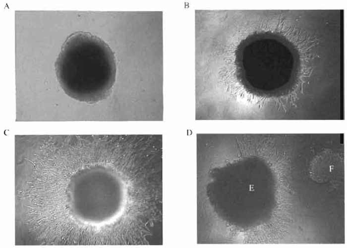 FIGURE 2 Mouse endothelial cells SVEC4-10 migrating from a dense "clump" of the cells into Matrigel containing an angiogenic compound: (A) 0 h of cultivation, (B) 24h, (C) 48 h, and (D) chemotactic activity of an angiogenic compound. E, endothelial cells; F, tumor cells.