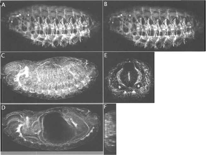FIGURE 2 A projection of four optical sections of a late Drosophila embryo stained with phalloidin to highlight actin in somatic muscles (A) is compared to a single optical section (B). Note that some muscles (asterisk in A) are not visualised in the single optical section. A projection of 42 sections of a Drosophila embryo stained with phalloidin is used to visualise actin in the whole embryo (C). A single optical section through the same embryo (D) reveals staining in internal structures that are obscured by the extensive surface staining in C. A confocal generated X-Z section along the Z axis depicted by the white line in D is shown in F. Such a scan provides very poor resolution. A single optical section of a thick section cut (as described in Section III,H) to include the same region of the embryo as shown in D is shown in E. Such a section resolves the apicobasal extension of actin especially in internal organs that are obscured in whole embryos. In all images, the dorsal surface of the embryo is on top. 
In A-D, the anterior end of the embryo is on the left.