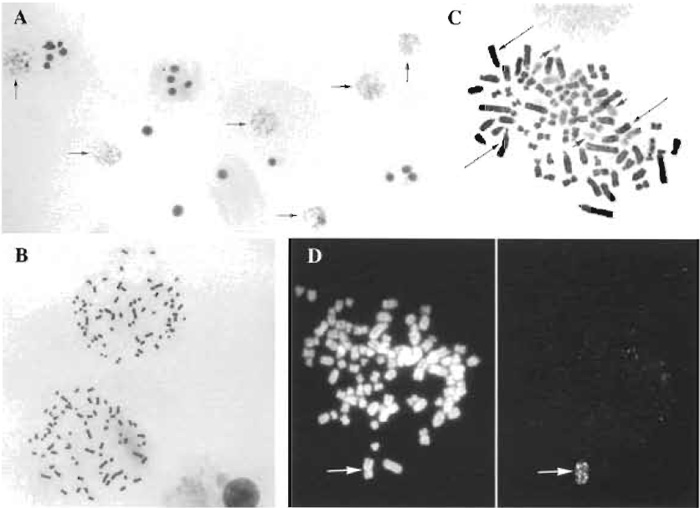 FIGURE 1 Metaphases from HT29 and hybrid WIF lines. (A) HT-29 cells at low magnification; metaphases were obtained at a high yield as attested by the presence of six metaphases (arrows) among some 30 cells. (B) HT-29 metaphases at a higher magnification to illustrate chromosome spreading. (C) Detection of human (pale staining, small arrows) and rat (dark staining, long arrows) chromosomes by Giemsa 11 staining in a metaphase of the human x rat hybrid WIF-B. (D) Detection by FISH (right) of one copy of the human chromosome 2 (arrow) in a WIF 12-E metaphase that was counterstained with propidium bromide to show all the chromosomes (left).