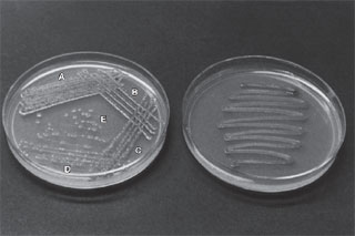 Plate streaking. (a) Notice how the proper technique is designed to yield isolated colonies in areas D and E. (b) Poorstreaking does not provide separation of colonies.