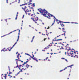 Bacillus spp. are gram-positive bacilli with endospores. Endospores appear as clear areas within the vegetative bacterial cell (arrows).