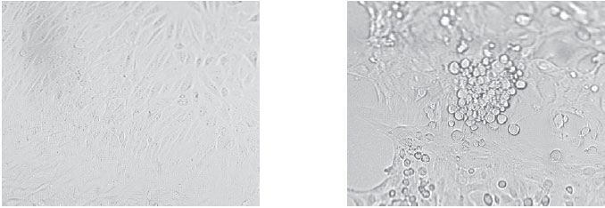 Cell culture of adenovirus. The uninoculated cells on the left form an even monolayer (one cell thick) in the culture tube. Once the cells are infected with virus (right), they undergo a characteristic cytopathic effect, becoming enlarged, granular in appearance, and aggregated into irregular clusters.