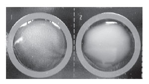 A positive latex agglutination reaction for group A streptococci. The left-hand well shows a very fine, granular precipitate. In this well, the group A carbohydrate antigen has combined with latex beads coated with antibody against this specific antigen. The well on the right (group B antigen) remains negative, showing only the milky suspension of nonagglutinated latex particles. This antigen does not react with the anti–group A antibodies on the latex particles.